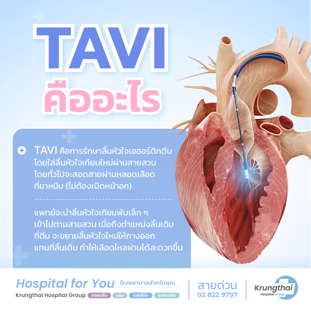 TAVI คืออะไร
